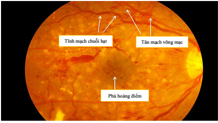 Hình ảnh