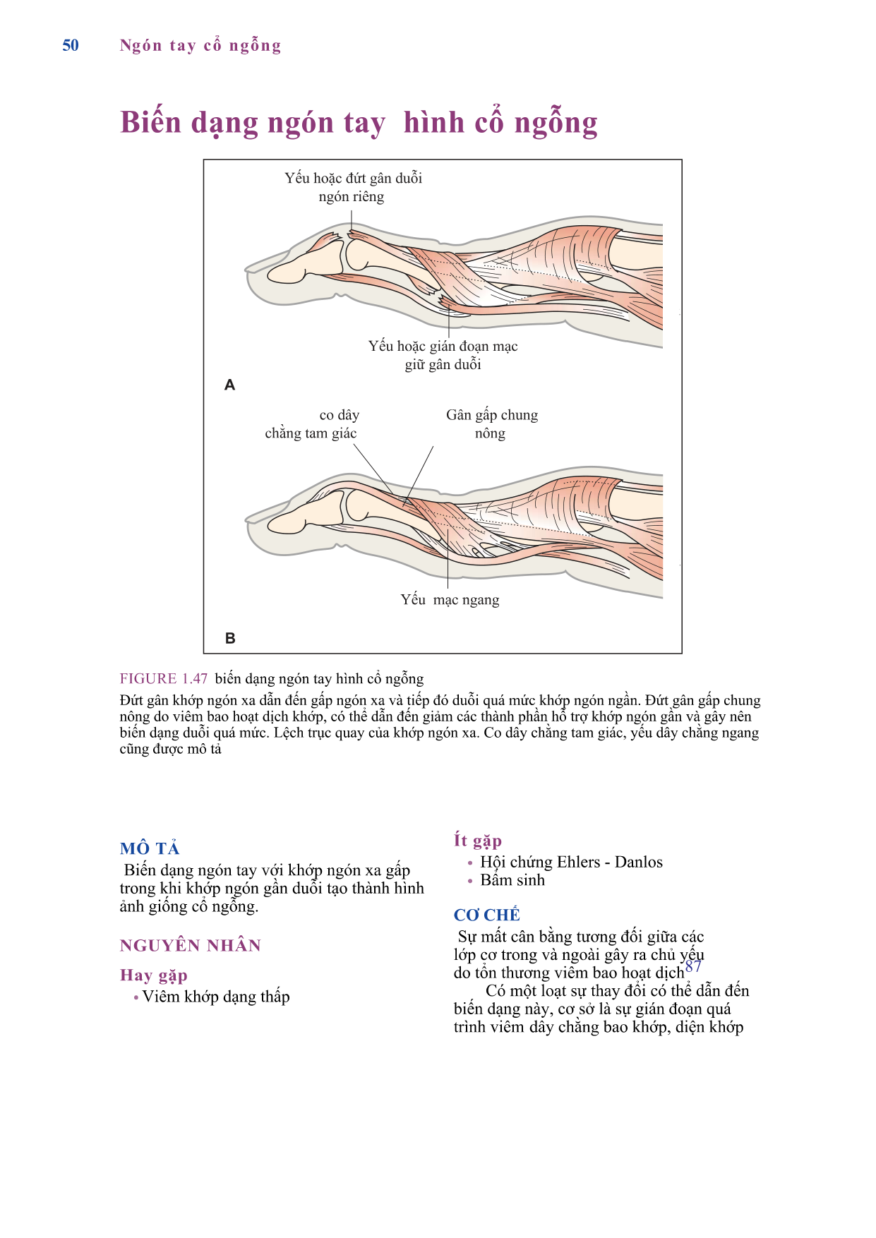 Hạt thấp dưới da