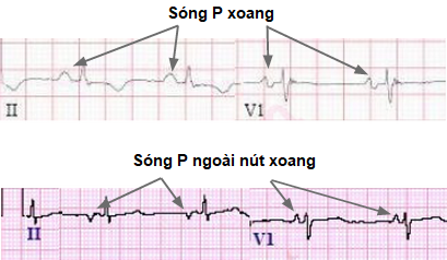 sinus