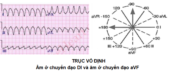 truc vo dinh