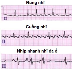 non sinus