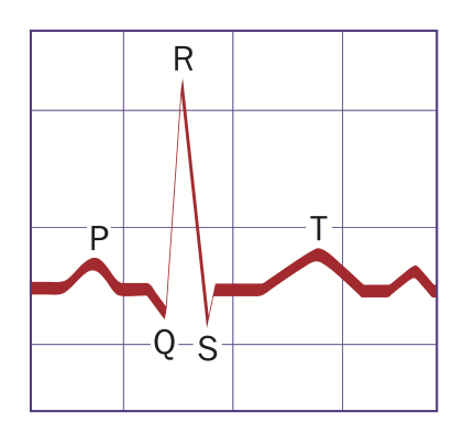 QRS