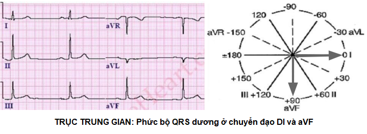 ECG axis