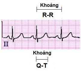 QTInterval